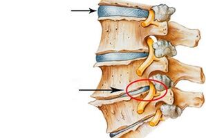 bolovi u zglobovima u koljenu liječenje artroza zgloba liječenje masnim tkivom