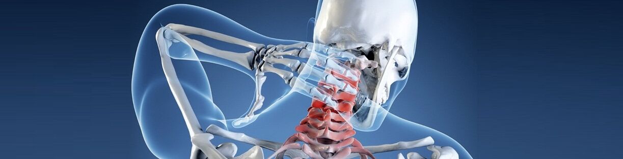 Osteohondroza vratne kičme kod čovjeka