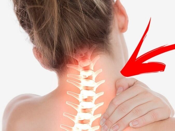 Kompresija nervnih korijena sa cervikalnom osteohondrozom