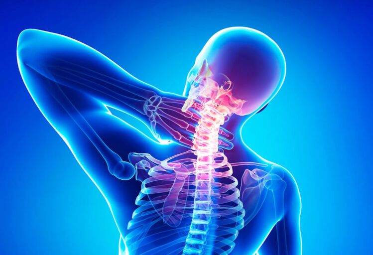 Osteohondroza grlićnje kralježnice