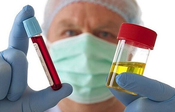 Načina za dijagnosticiranje osteohondroze grlića materice